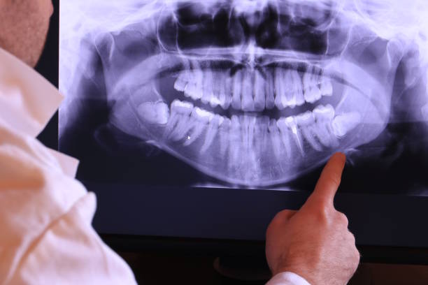 Best Broken or Cracked Tooth Emergency Dentist in Penn Wynne, PA